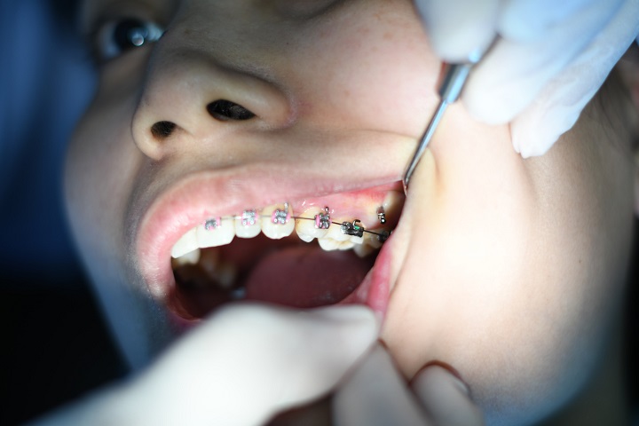 Are we ready for green dentistry?